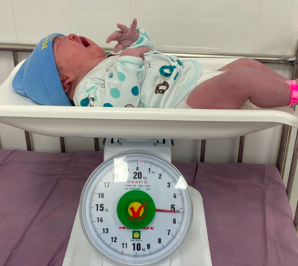 Bác sĩ mỏi tay đón bé gái nặng 5,3kg ra khỏi bụng mẹ